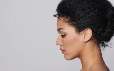 Eliminate Your Double Chin with KYBELLA