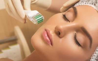 What Does Microneedling Do for Your Face? 5 Microneedling Benefits